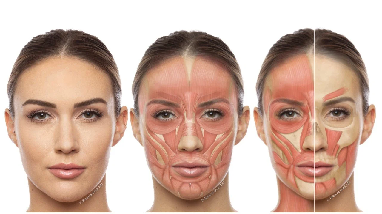 Dr. Rebecca Small's patient shown with anatomy of muscles