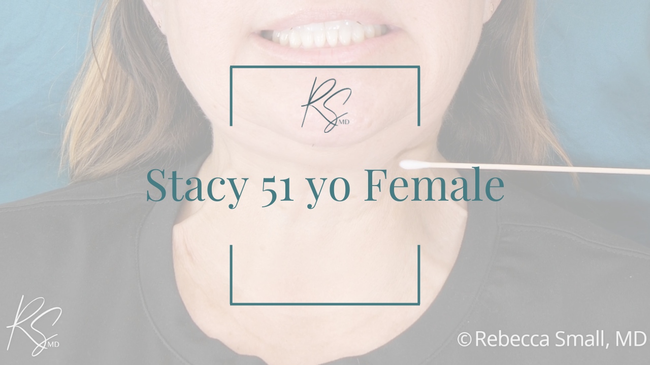 A woman smiling in a medical office with text overlay: "Stacy 51 yo Female," and a logo with the initials 'RS MD,' along with the copyright notice to Rebecca Small, MD.