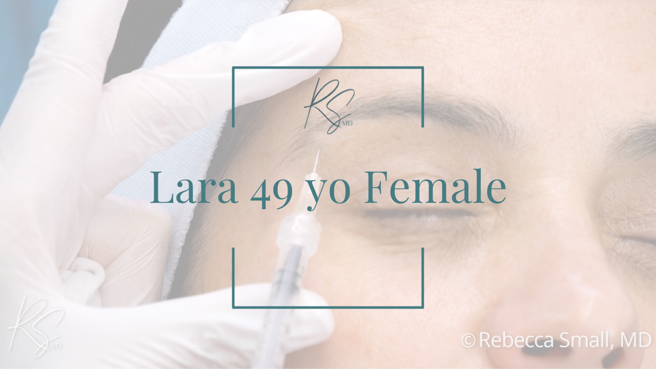 Close-up of a woman receiving an injection to her forehead by a healthcare professional wearing gloves, with text overlay indicating she is a 49-year-old female named Lara.