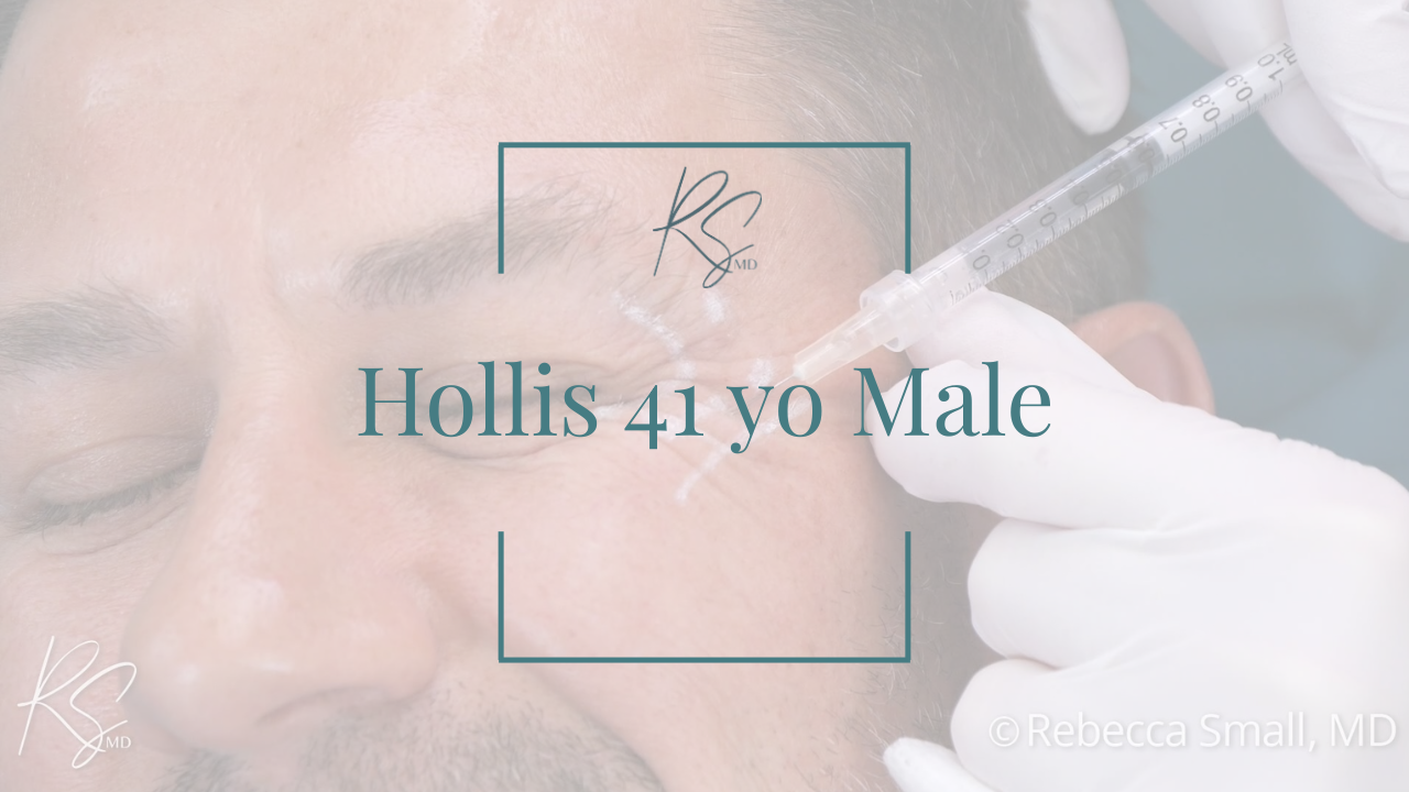 Medical procedure with a person receiving an injection near the eyebrow, wearing gloves, with text overlay indicating the person's name, age, and gender.