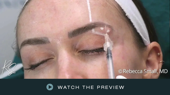 Close-up of a woman receiving an injectable cosmetic treatment near her eyebrow with her eyes closed.