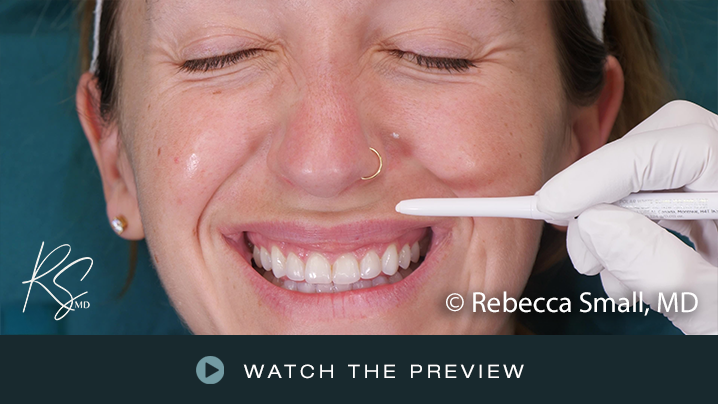 A woman smiling with closed eyes as a healthcare professional uses a swab on her nose during a medical procedure.