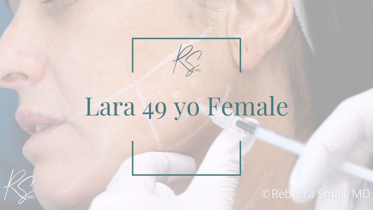 Close-up of a woman receiving a cosmetic facial injection on her cheek from a healthcare professional wearing gloves, with text overlay indicating the patient's name, age, and gender.