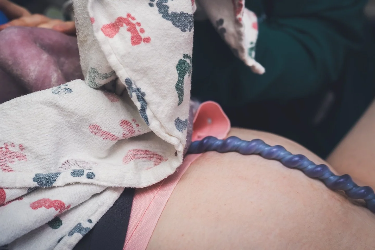 this umbilical cord lives rent free in my head 🌳✨✨