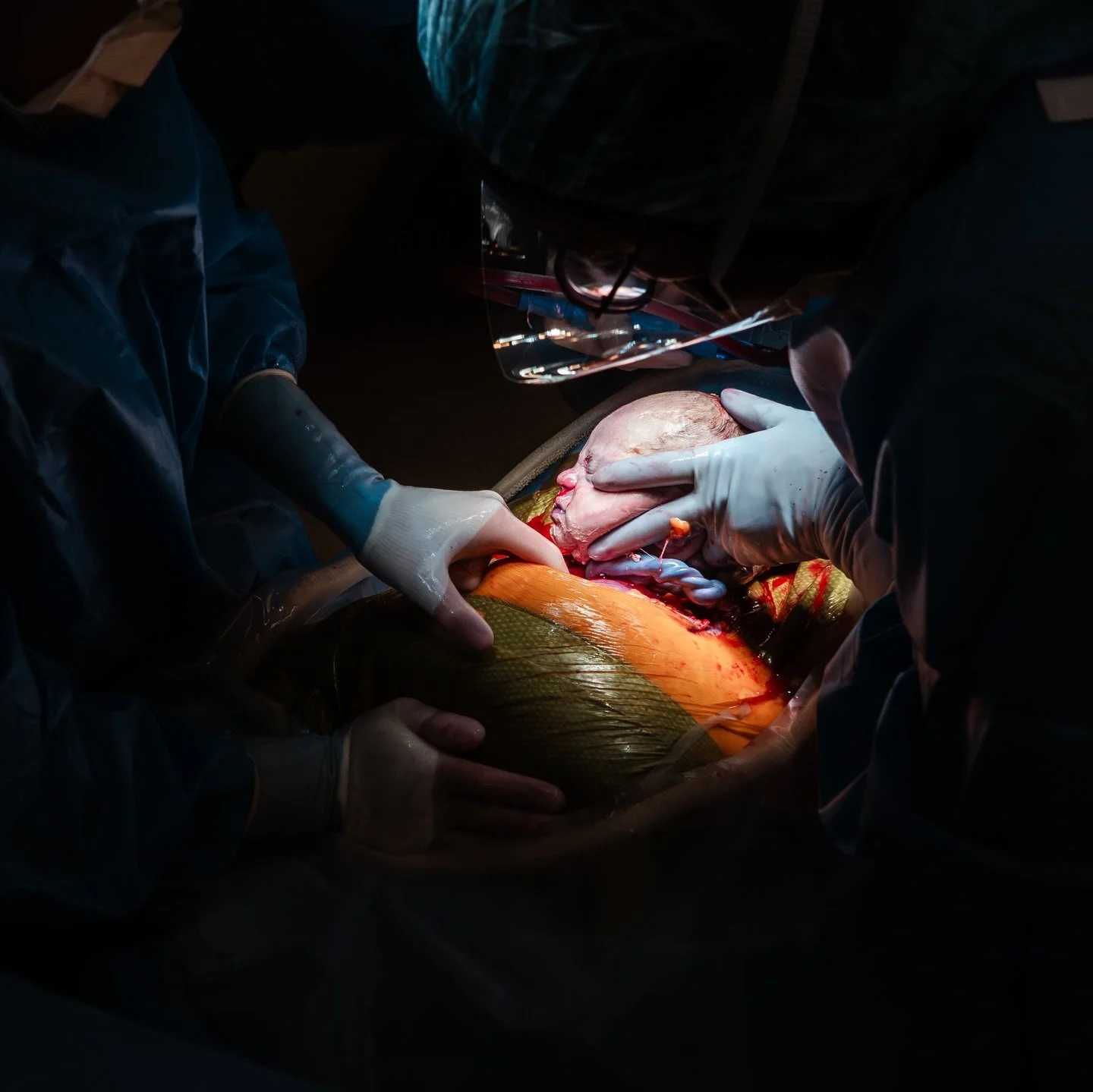 Cesareans can still be empowering. 
Cesareans can still be family centered. Cesareans can still be peaceful. 
Cesareans can still have informed consent. 

And sometimes cesareans can still be the absolute best way to birth your baby. When plans pivot