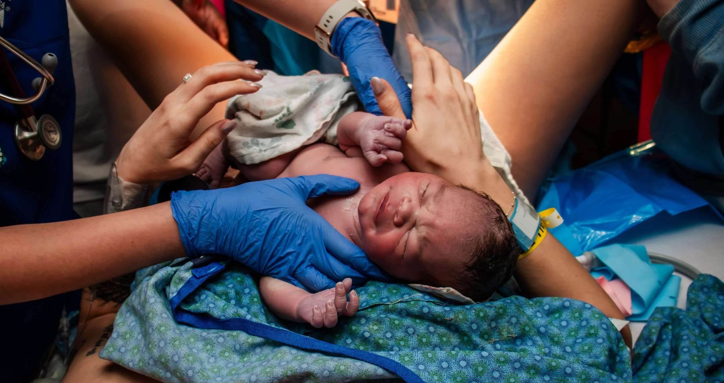 A newborn baby is being delivered in a hospital operating room, with medical staff assisting during childbirth.