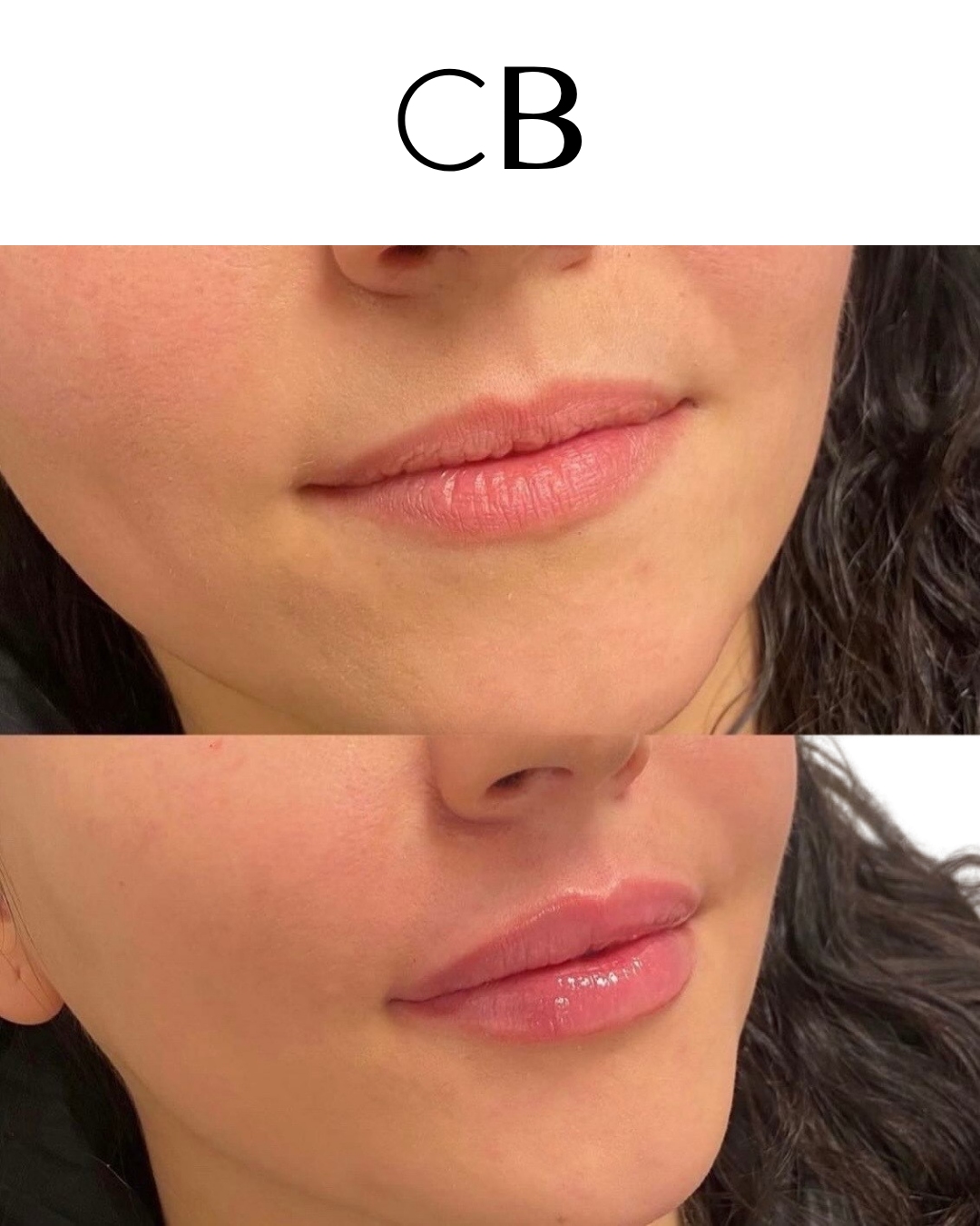139.png