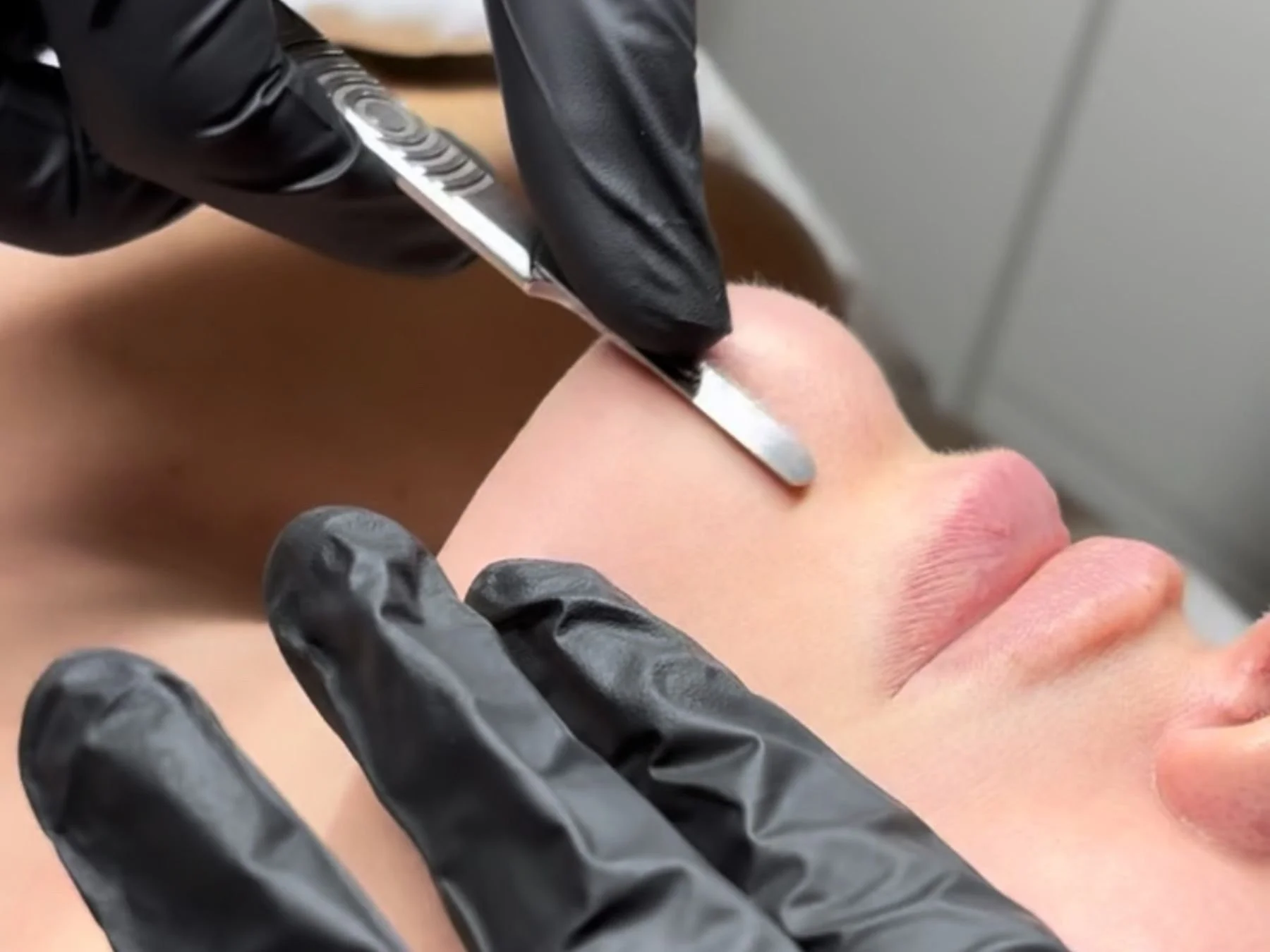 dermaplane in spokane