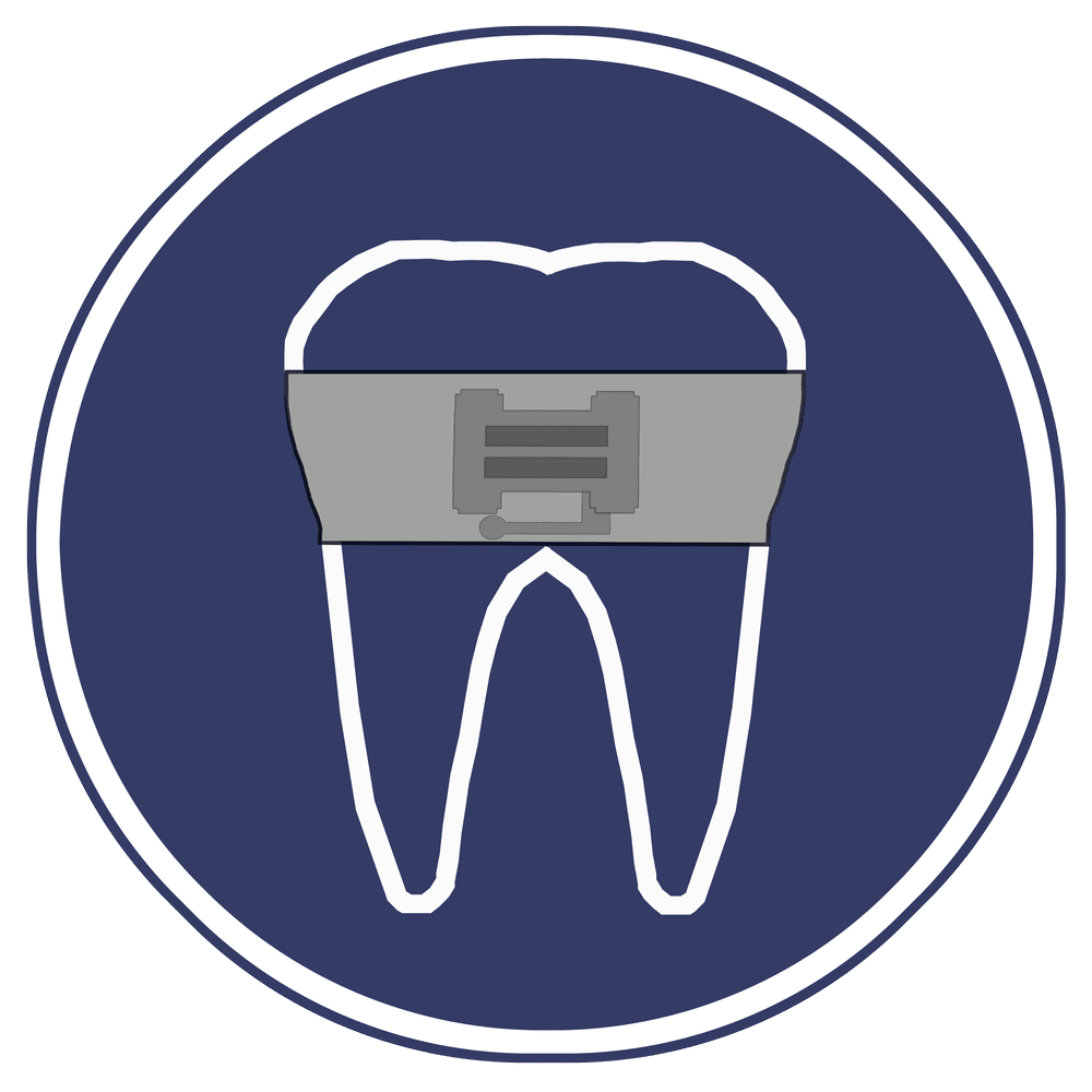 Orthodontics (braces) — Dr. Joe Wang