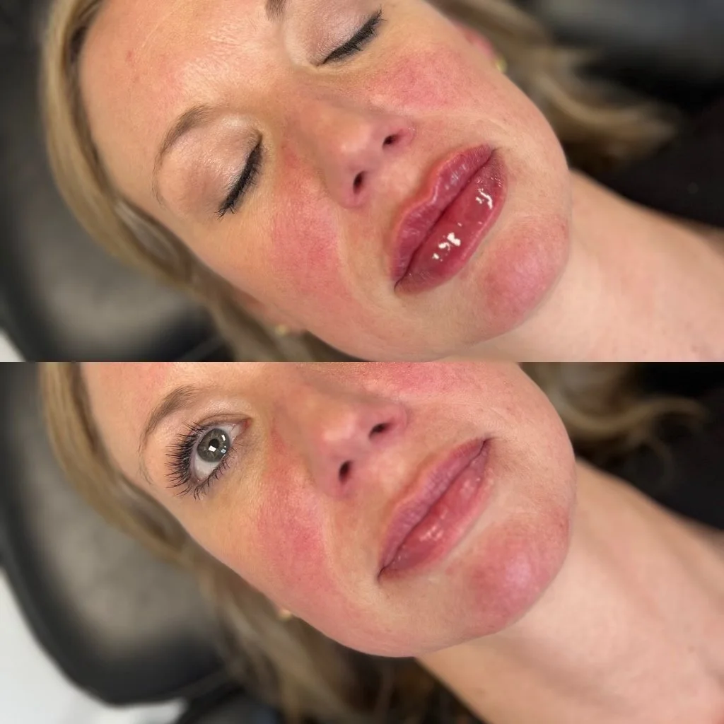 CBBefore and After VOSS.jpg