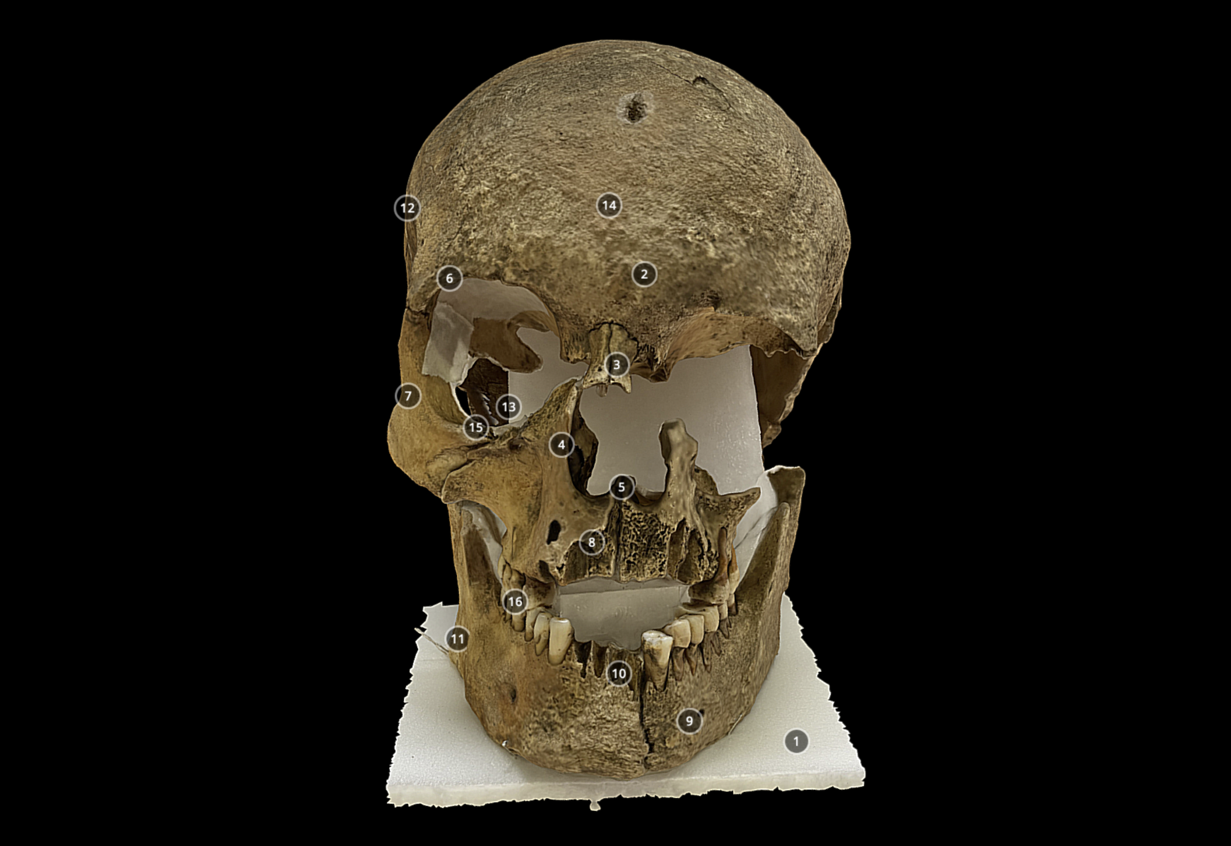 Silence of the Sentinels update: Hartlepool