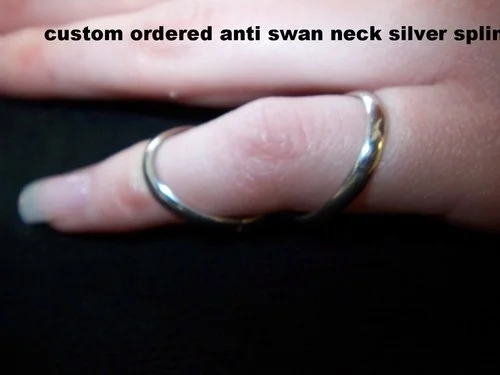 silver+ring+splint.jpg