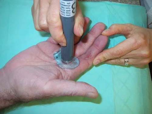 ultra+sound+treatment-3.jpg