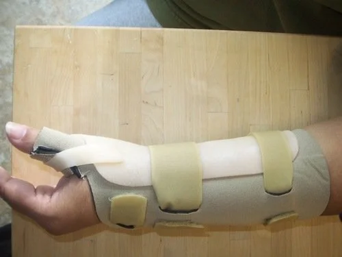 modified+readyfit+forearm+thumb+spica+splint+2.jpg