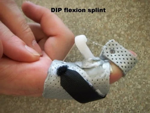 finger+tip+dynamic++flexion+splint-side+view.jpg