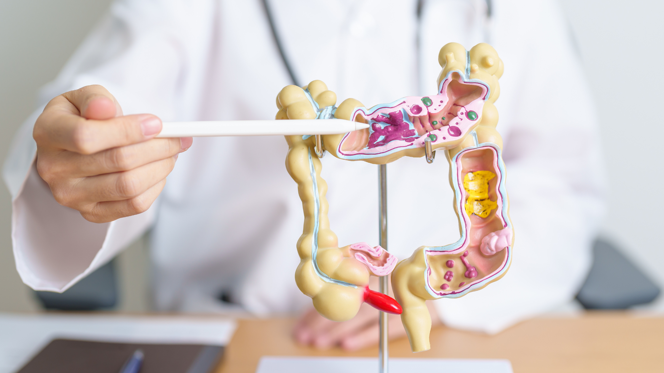 Colon Cancer Prevention: What You Can Do to Lower Your Risk