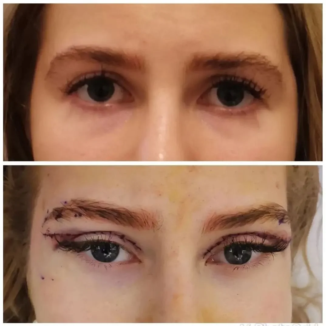 Top: Close-up of eyes with natural eyebrows. Bottom: Close-up of eyes with marked eyebrows and eyelashes before an eyebrow procedure.