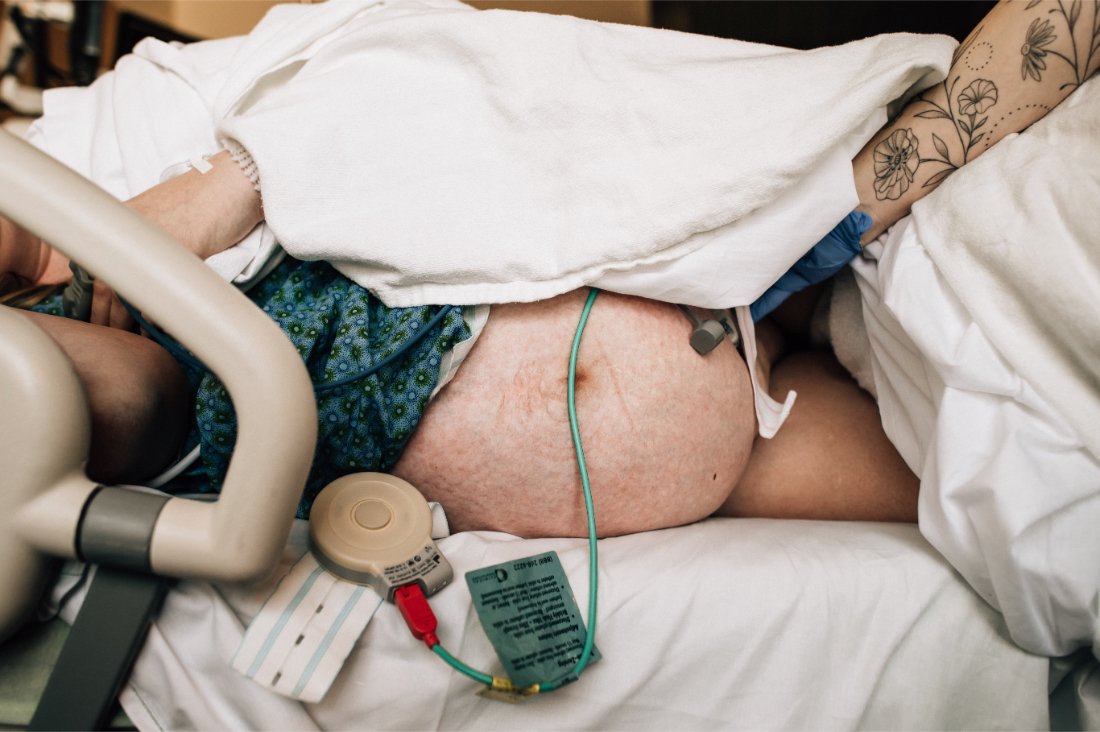 Close view of laboring parent’s belly with monitoring equipment visible, showing medical care considerations often addressed in a birth plan checklist.
