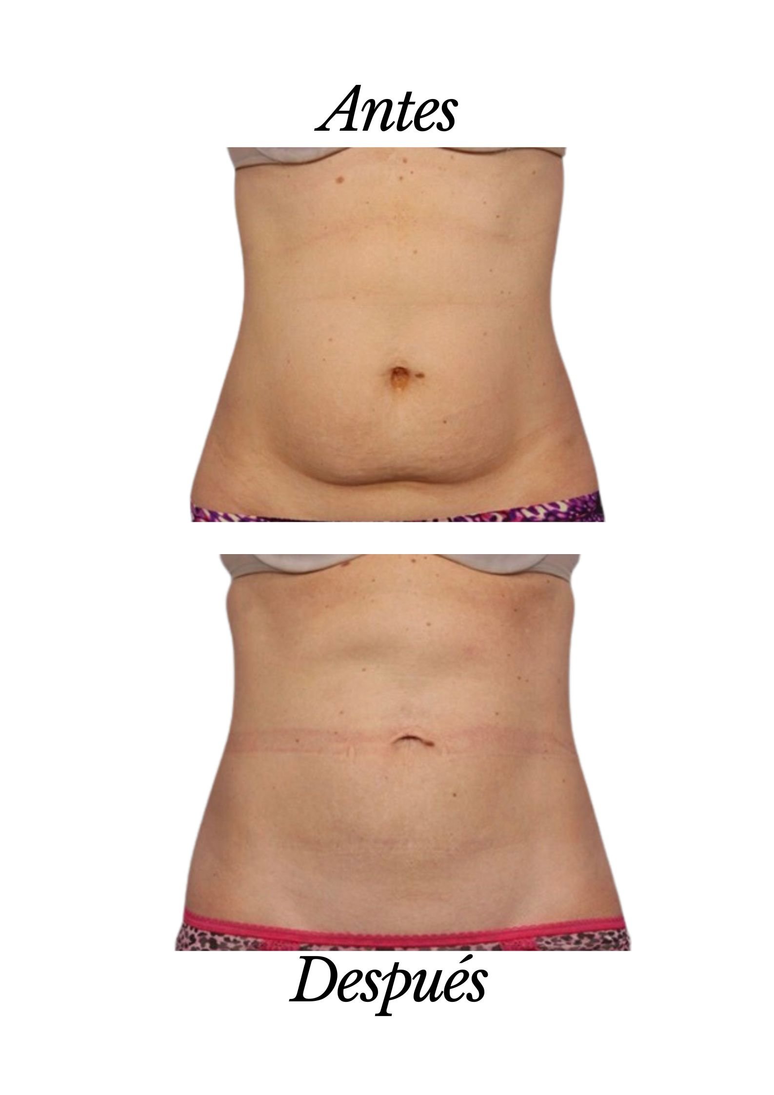 Black and White Bold We Are Close Poster.jpg