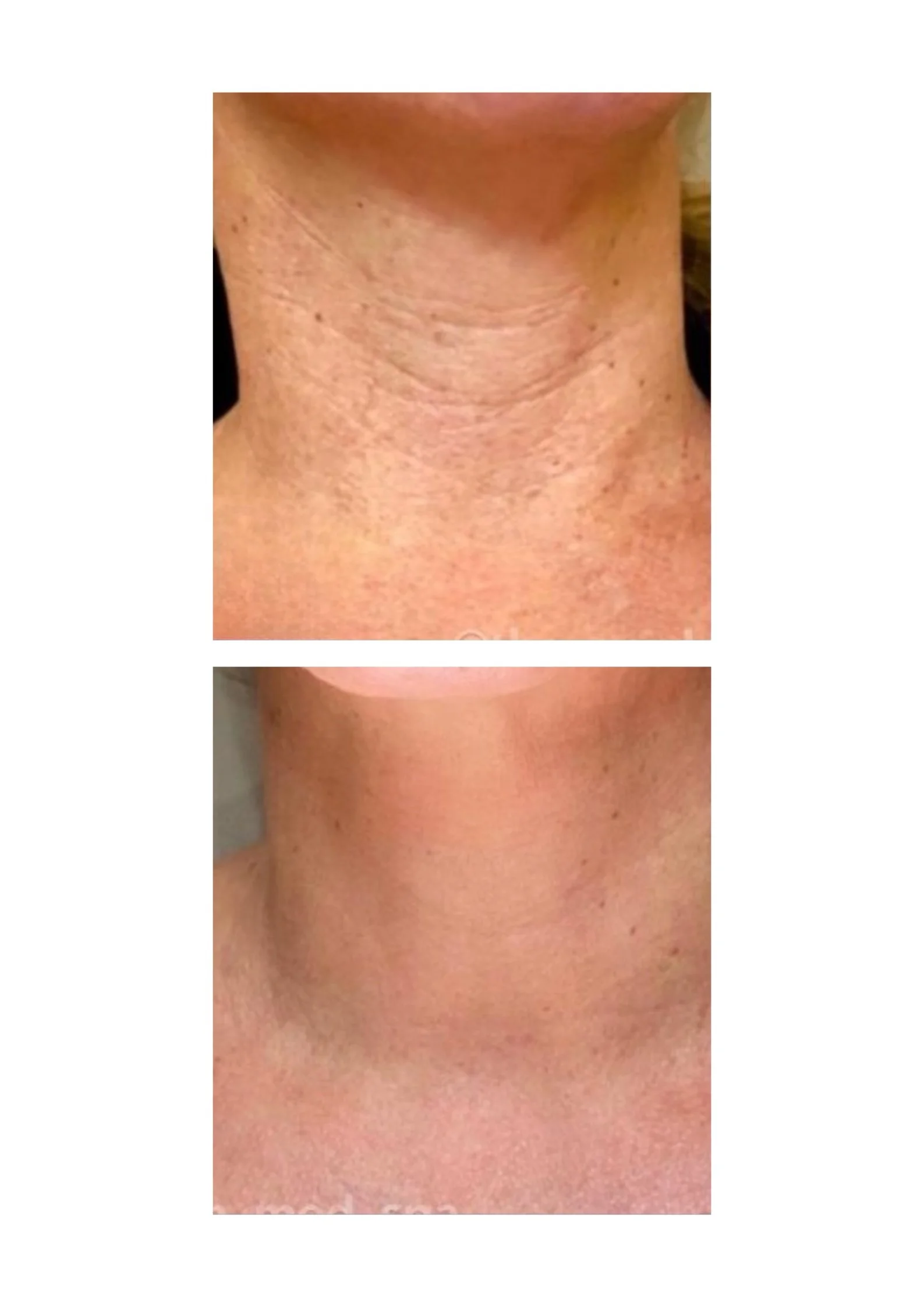 Black and White Bold We Are Close Poster.jpg