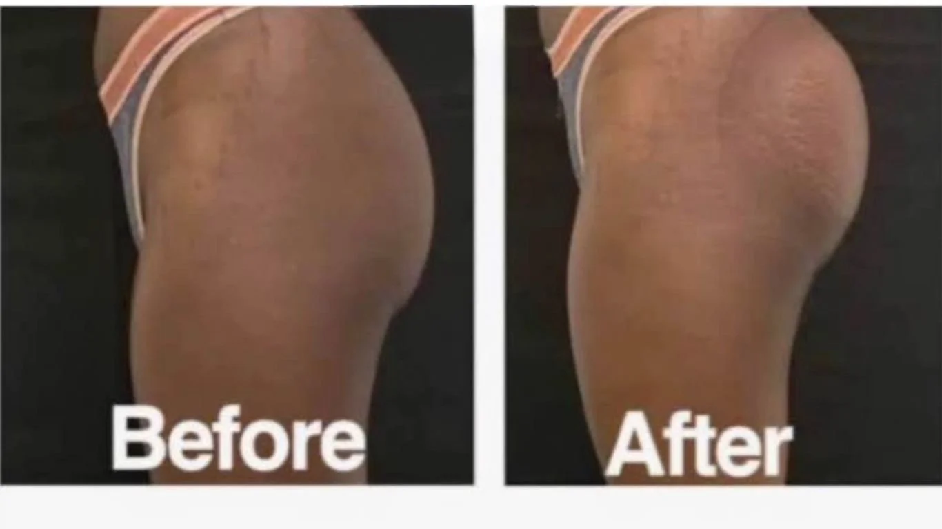 Comparison of a person's buttocks before and after a treatment or change, with the 'before' image showing less firm skin and the 'after' image showing firmer, smoother skin.