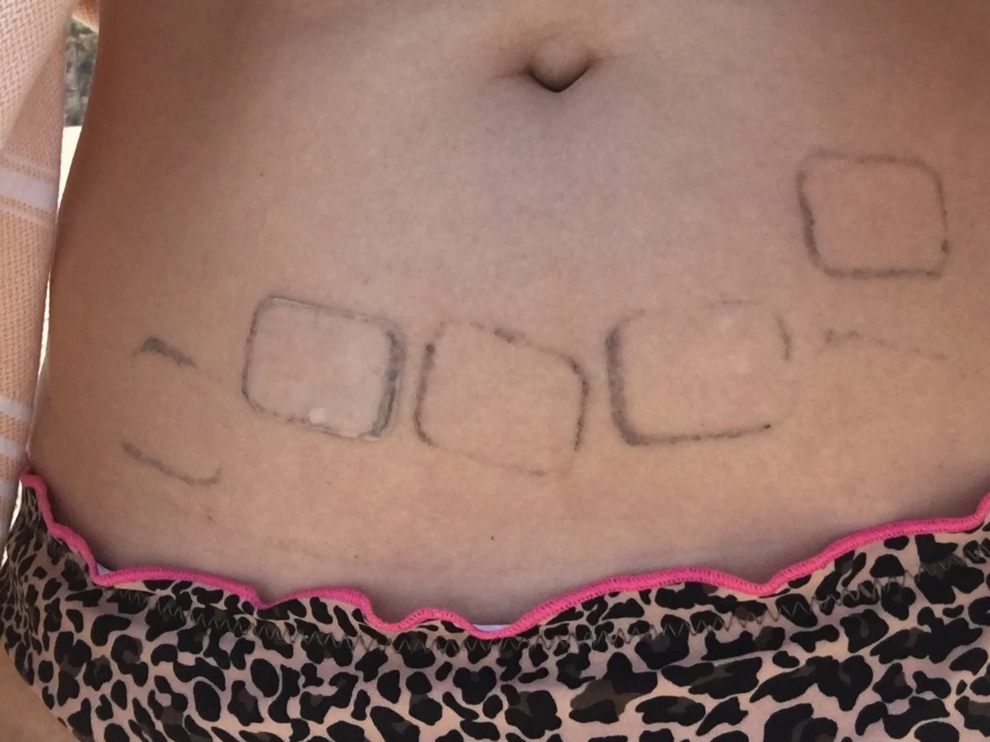 Me and My Body: Through Thick and Thin 