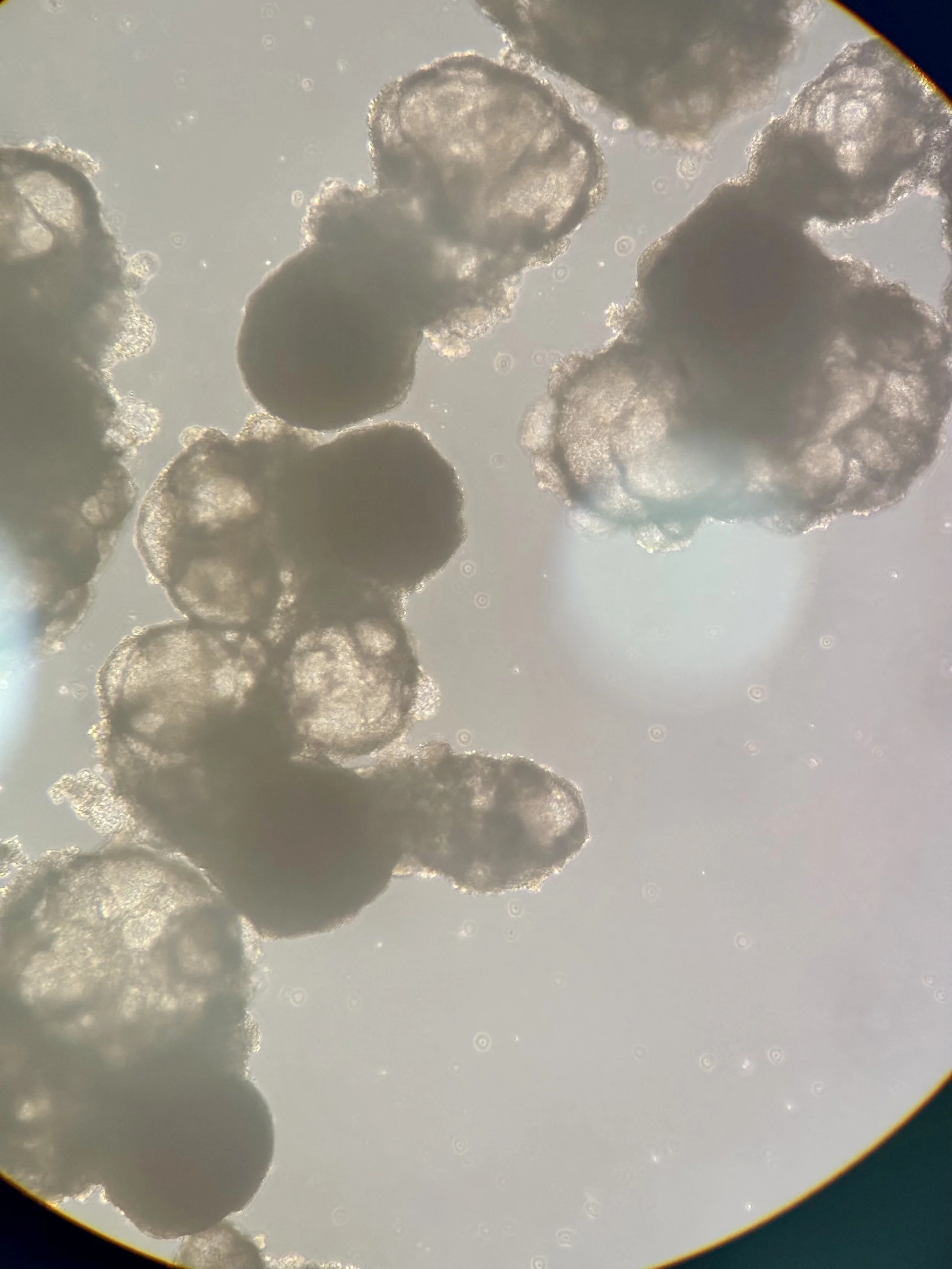 iPSC-derived yolk sac! 🍳 (2026.07.09)