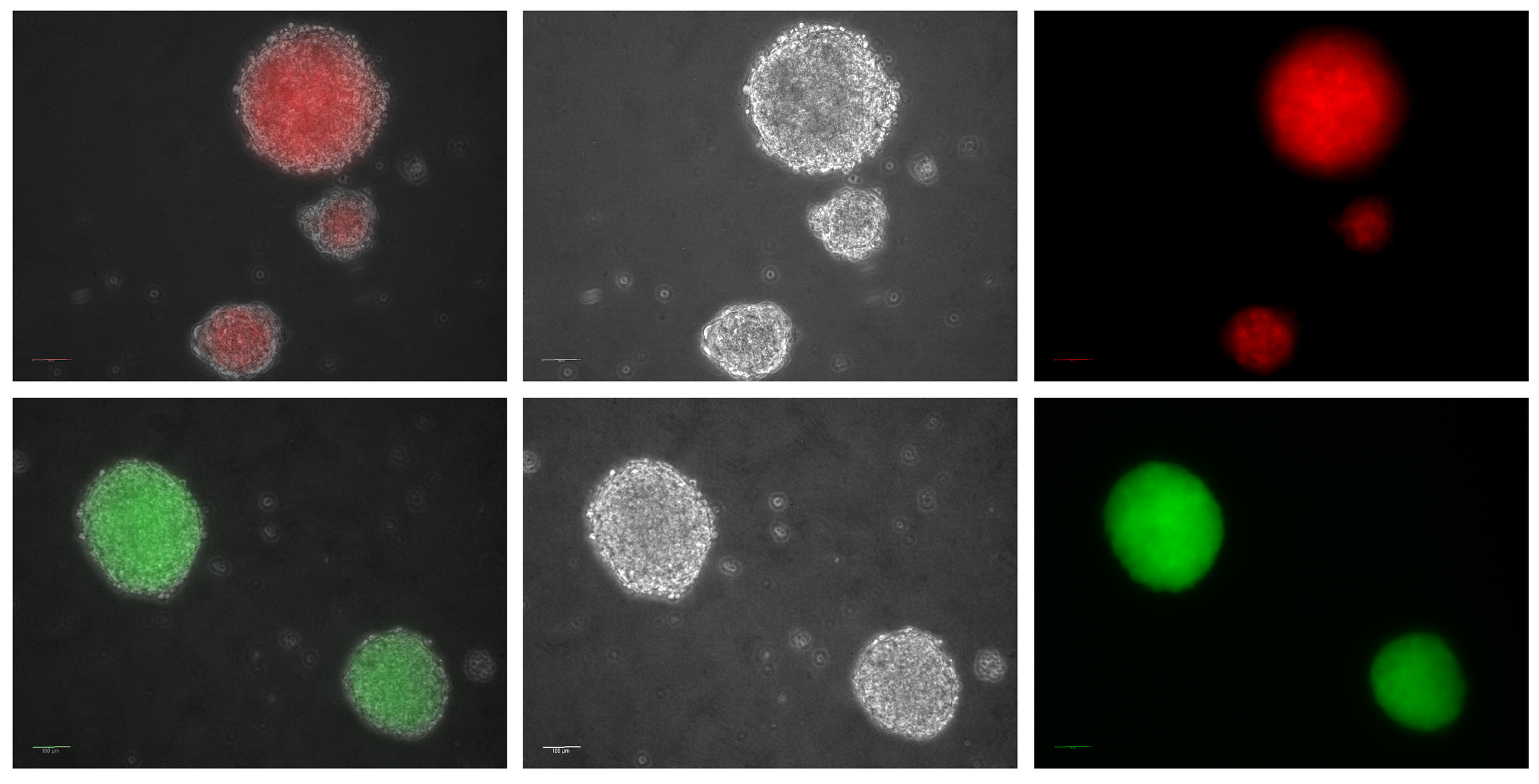 hES cell-derived GFP+ or tdTomato+ Astrospheres (by Jina & June
🧫)!