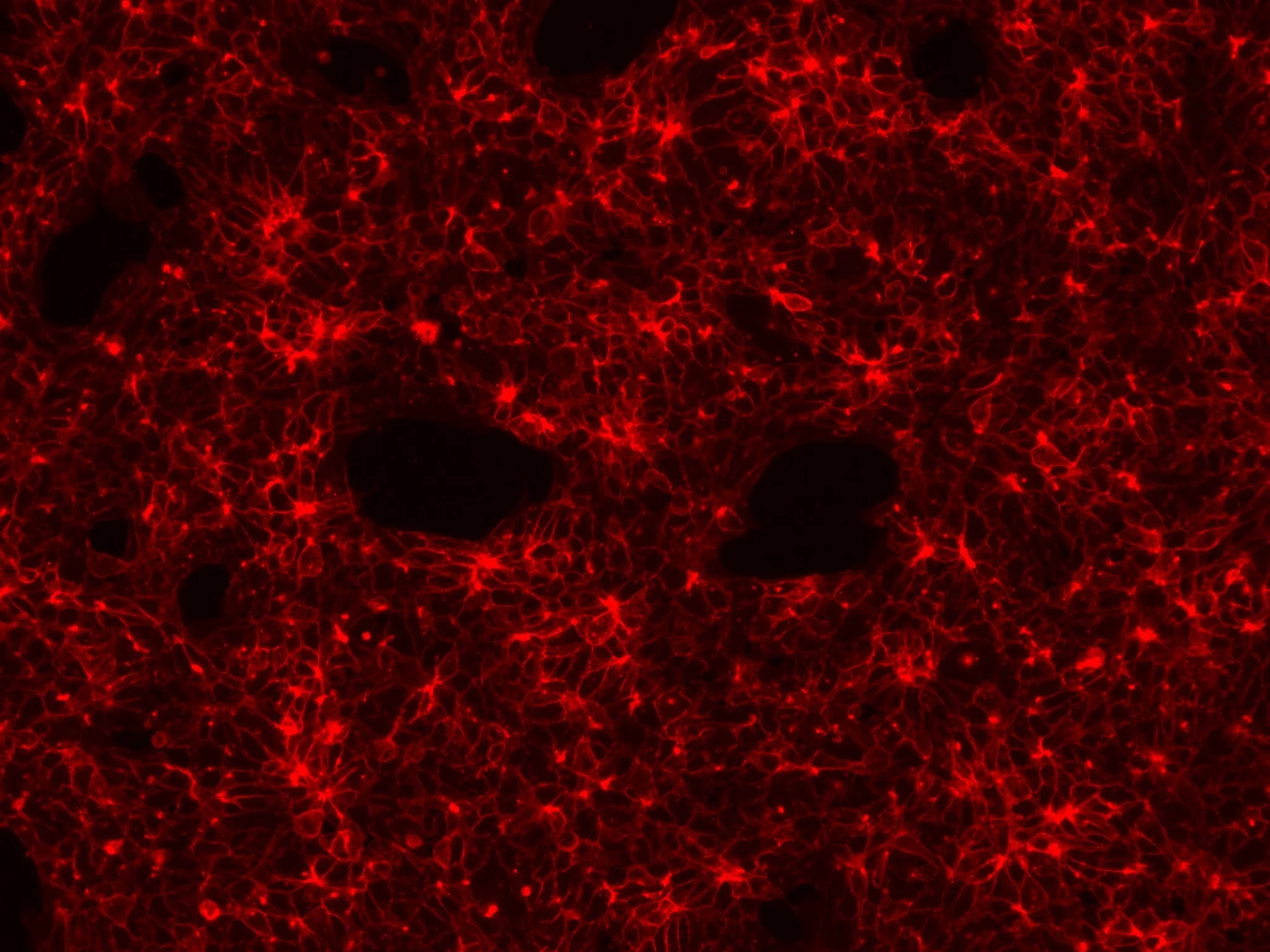 Our vert first tdTomato-labeled iPS cells! (2025.03.22)