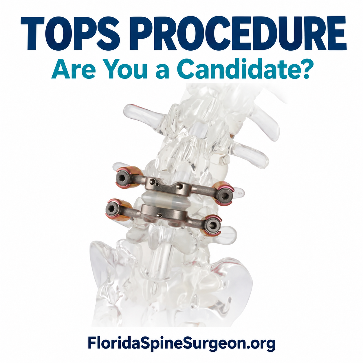 Are you a Candidate for TOPS?