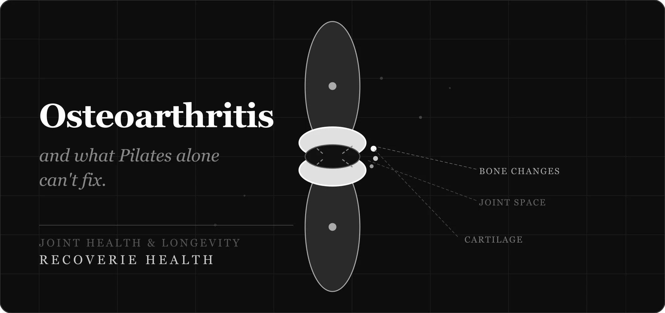 Pilates won't fix your osteoarthritis. 