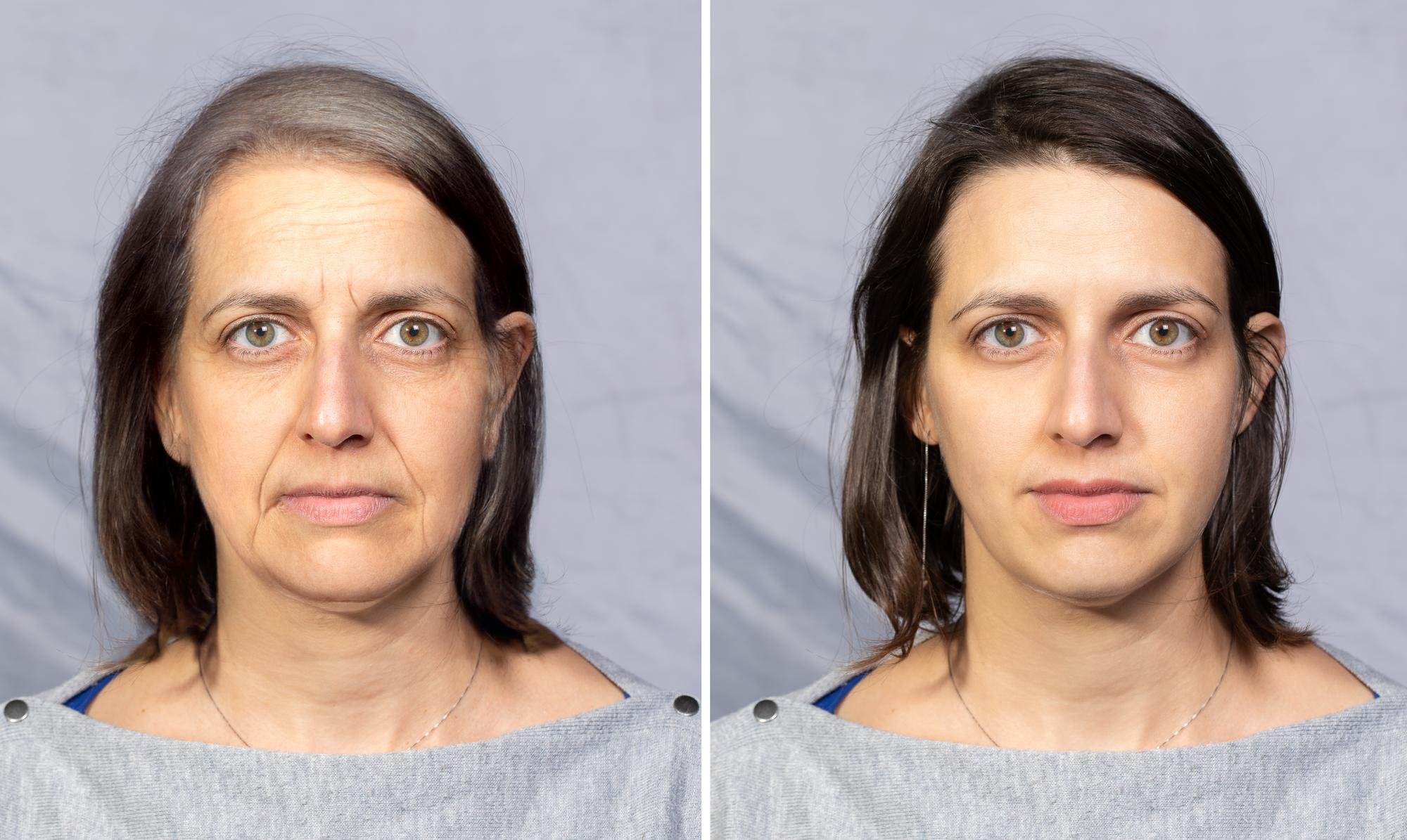 Side-by-side comparison of a woman with older, wrinkled skin on the left and younger, smooth skin on the right, indicating a before and after skin treatment or makeover.