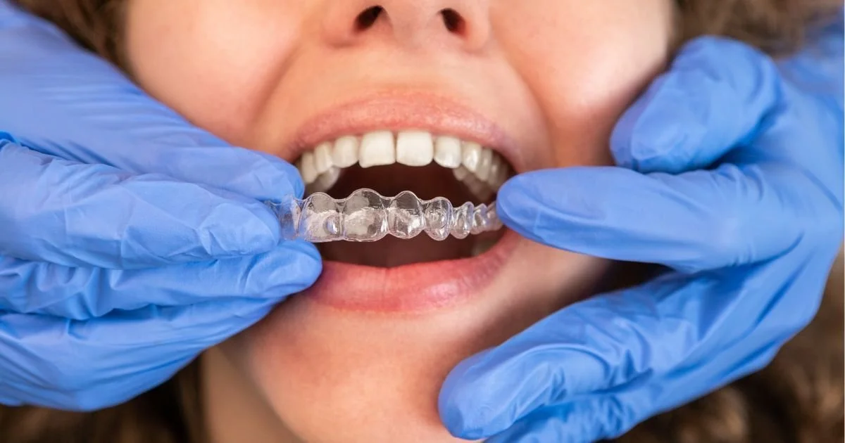 Debunking Myths and Exploring the Benefits of Orthodontic Treatment Later in Life