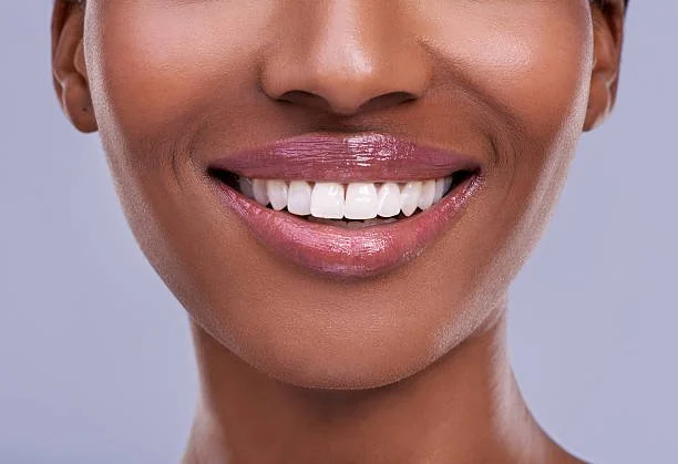 Top Foods and Habits That Stain Your Teeth and How to Avoid Them
