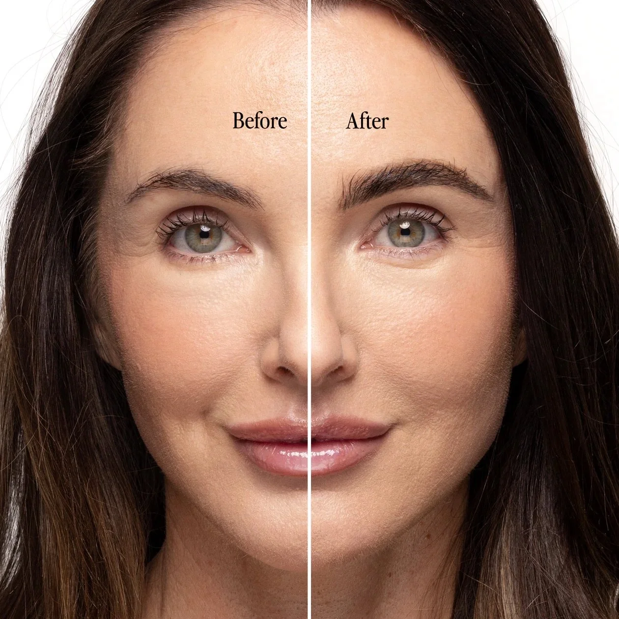Billion Dollar Beauty Campaign