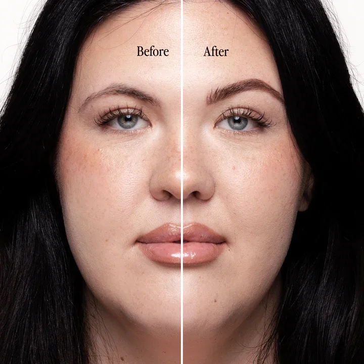 Billion Dollar Beauty Campaign