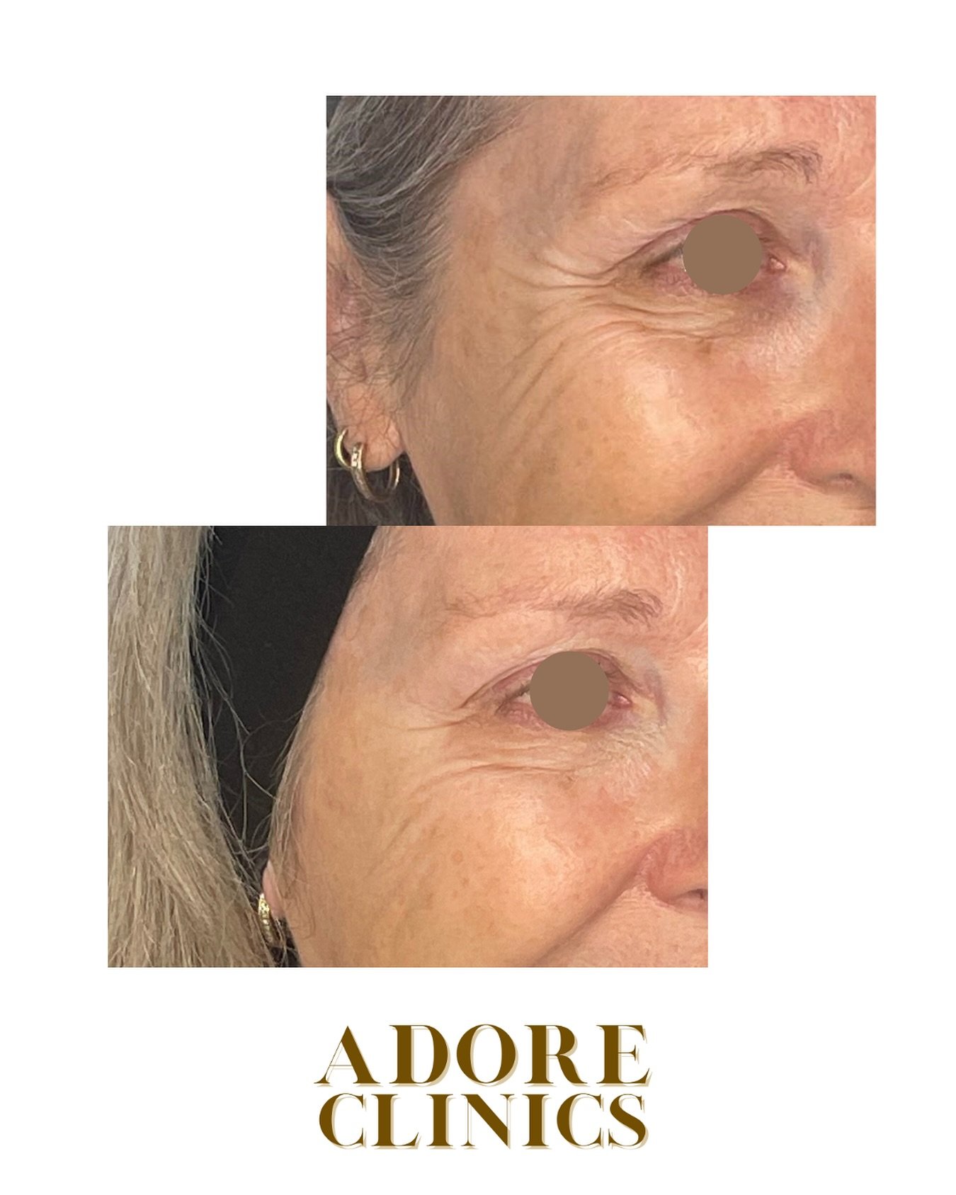 ✨Aging with Grace: The Role of the Aesthetic Eye✨

This Mother&rsquo;s Day, we celebrate the quiet strength, timeless beauty, and grace that define every mother&rsquo;s journey. 

Aging is a natural, beautiful journey&mdash;and when guided by a refin