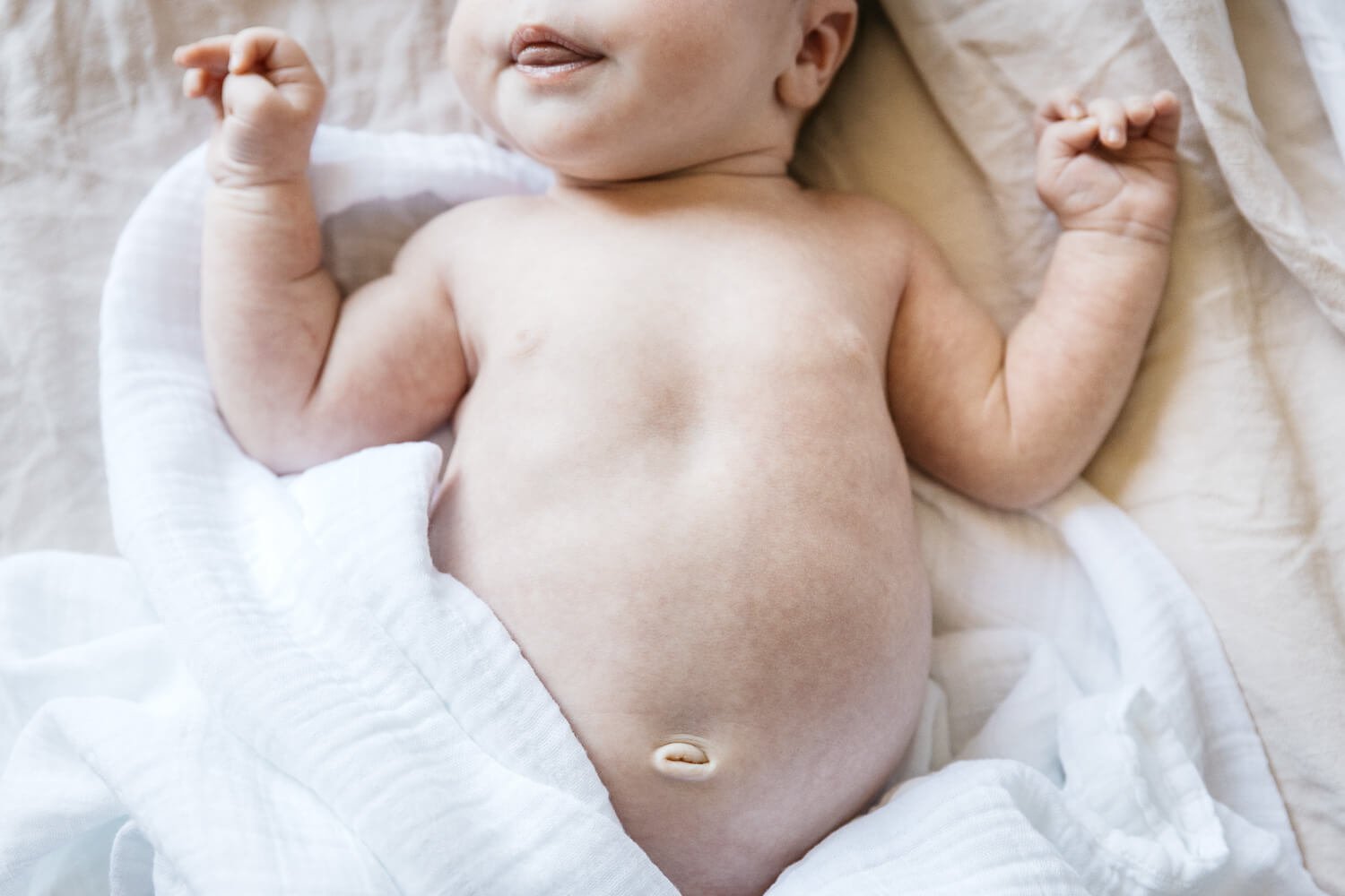 Cropped close-up of newborn baby chest and arms, with swollen belly, on white sheets.