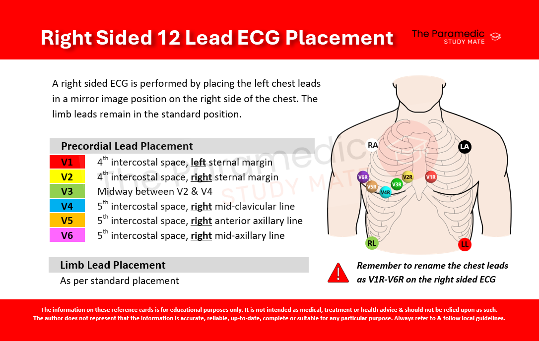 12 Lead Ecg Placement Diagram 12 Lead Placement Guide With Diagram