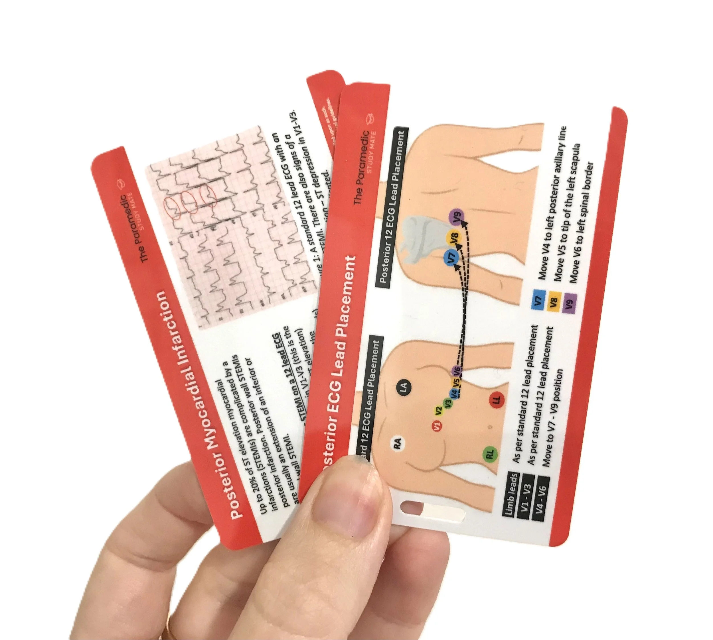 POSTERIOR ECG REFERENCE CARD HELD.jpeg
