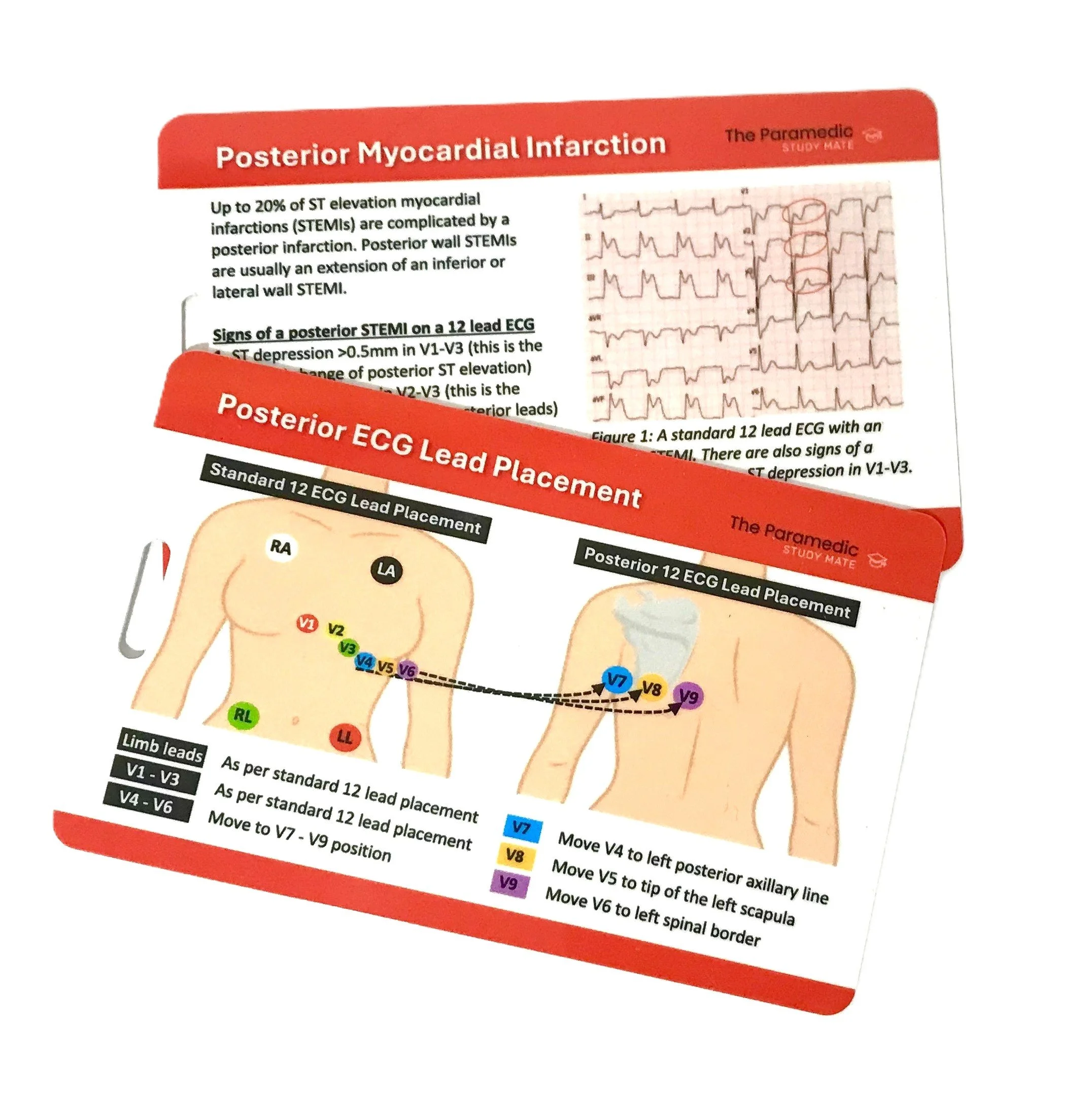 POSTERIOR ECG REFERENCE CARD .jpeg