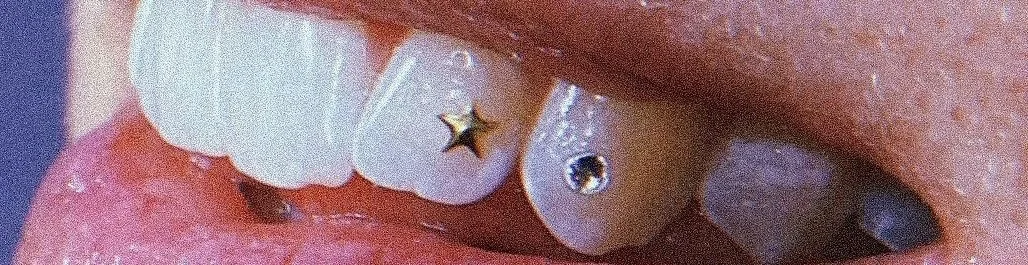 Tooth Gems