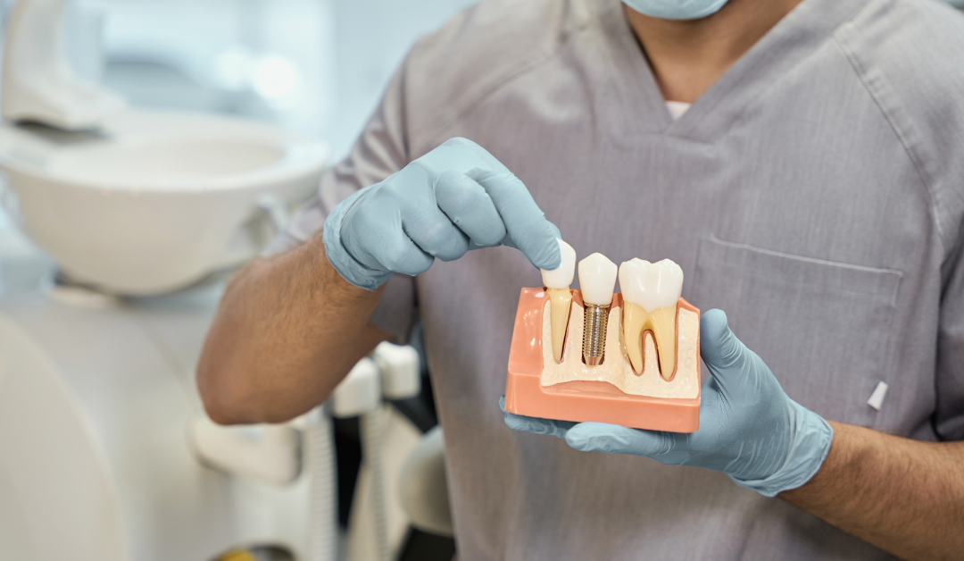 Why Your Implants Fail: Occlusion Mistakes You Didn’t Know You Were Making