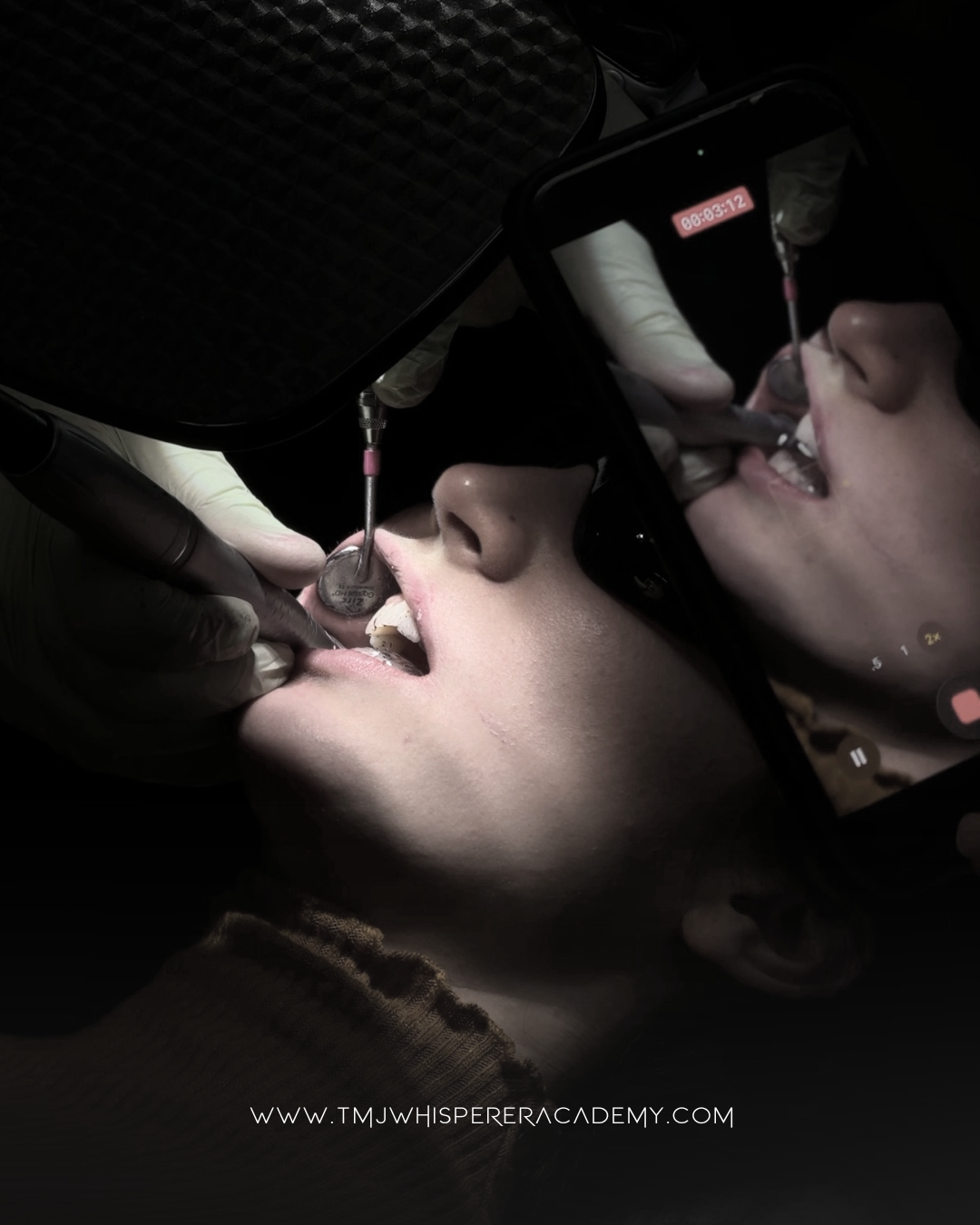 BiteAlign™ Orthotic Design and Adjustment