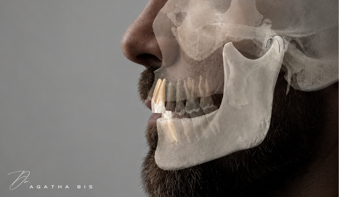 Night guards can protect teeth from grinding, but they do not necessarily control the forces behind bruxism. Dr. Agatha Bis explains what dentists should evaluate.