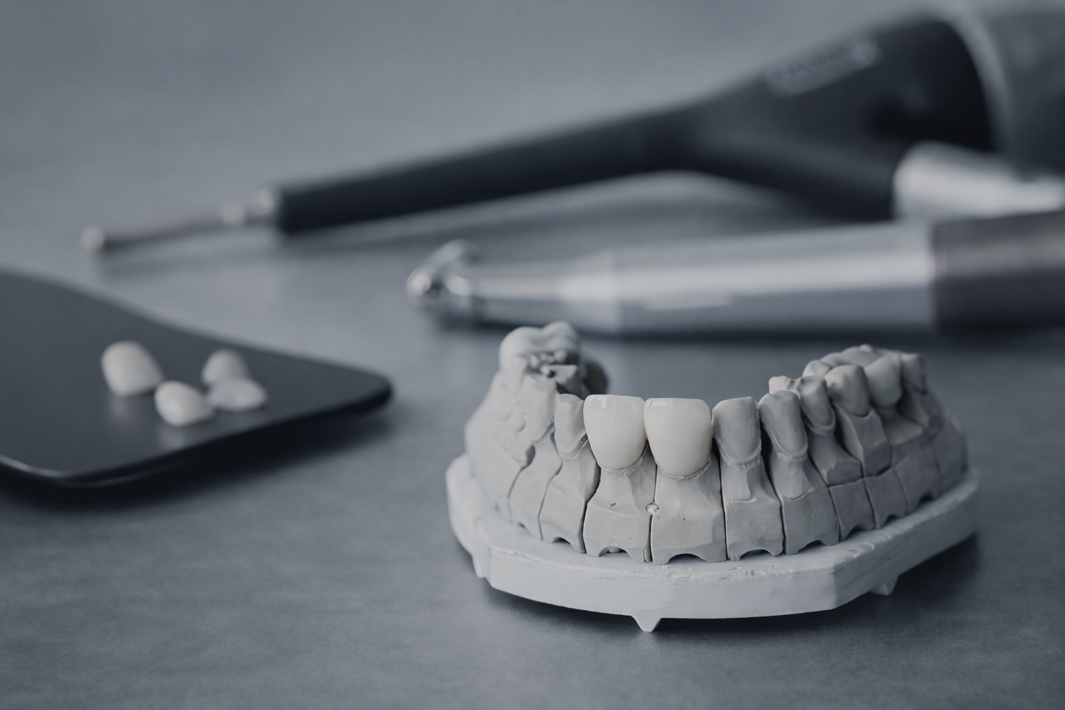 Restoration and occlusion - Dr. Agatha Bis