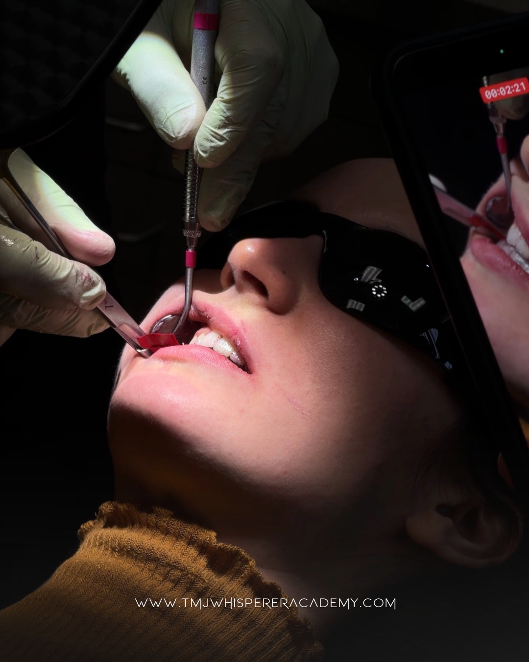 BiteAlign™ Orthotic Design and Adjustment