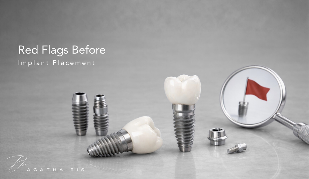 Red Flags Before Implant Placement