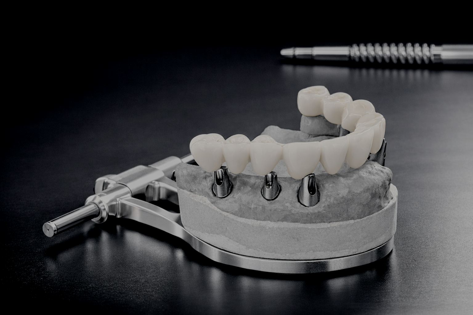 implants - CE course - Dr. Agatha Bis