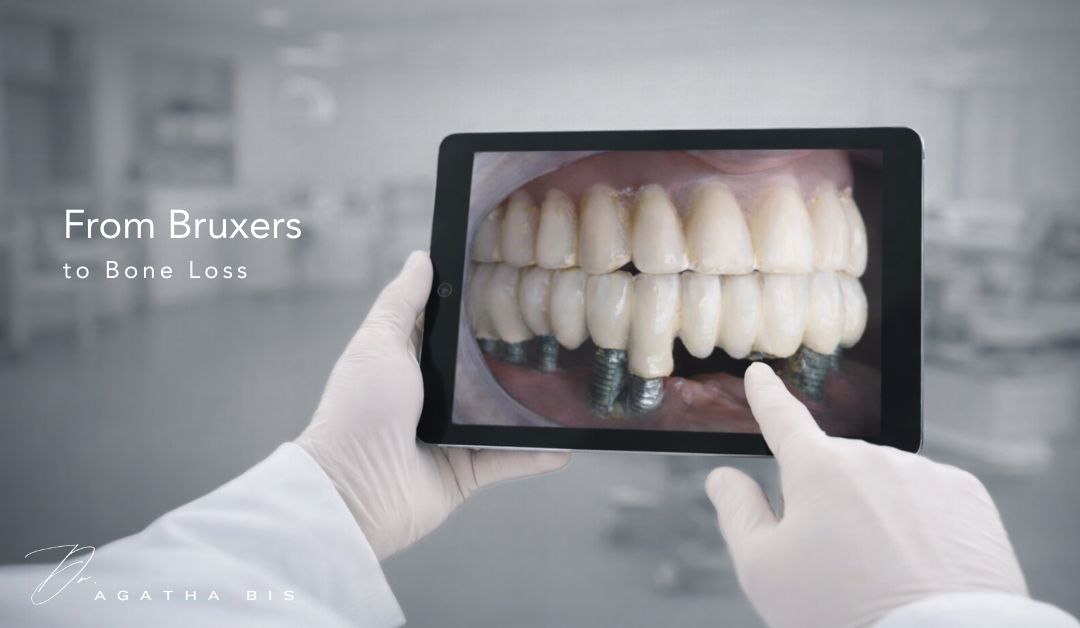From Bruxers to Bone Loss